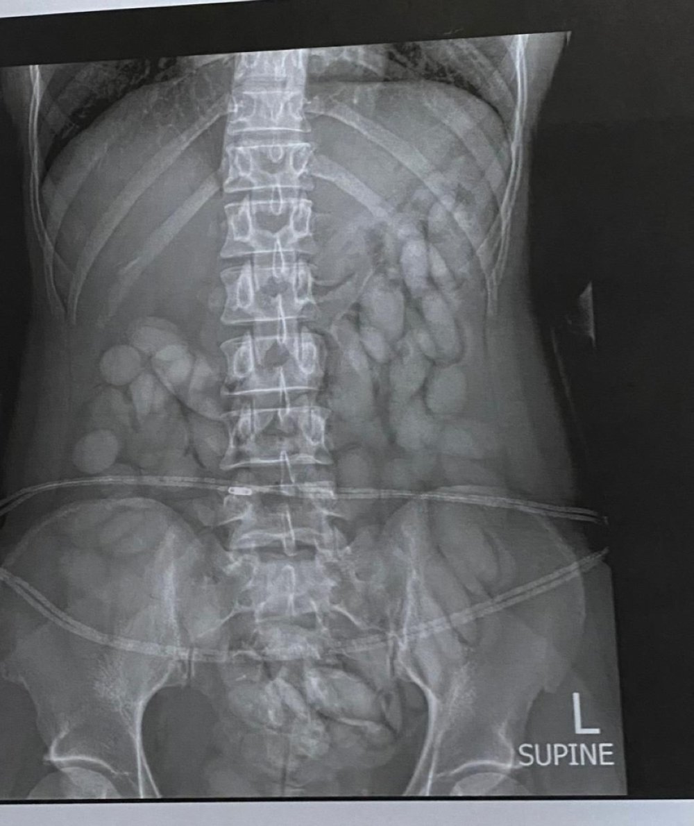 Drug in stomach